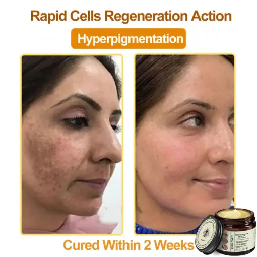 Awzlove™ Botox Bee Venom Rapid Skin Repair Cream