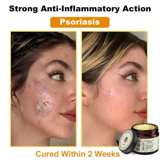 Awzlove™ Botox Bee Venom Rapid Skin Repair Cream