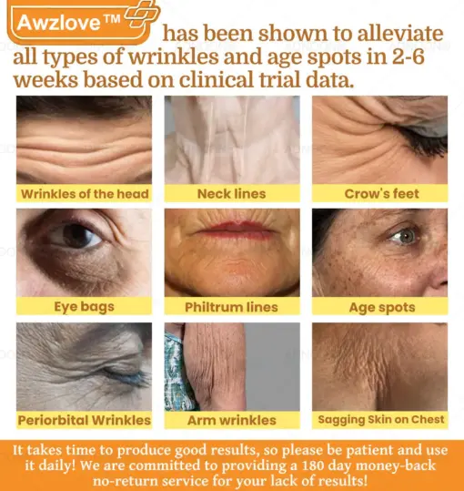 Awzlove™ Botox Bee Venom Rapid Skin Repair Cream