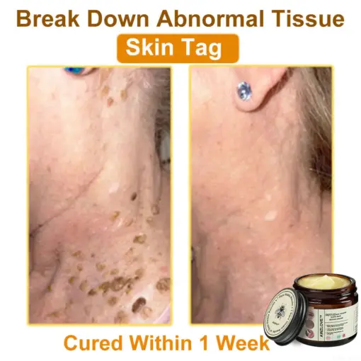 Awzlove™ Botox Bee Venom Rapid Skin Repair Cream
