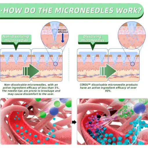 COROU™ SMGT-GLP-1 Nano Microneedle Patch