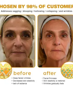 Jorondy® Instant skin tightening Cream