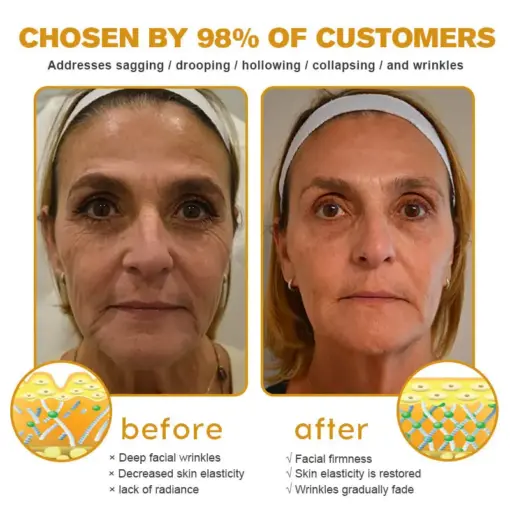 Jorondy® Instant skin tightening Cream