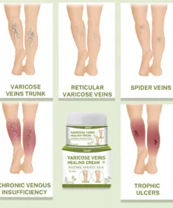 Timilk® Varicose Veins Healing Cream