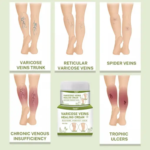 Timilk® Varicose Veins Healing Cream