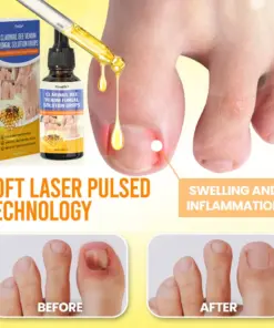 Timilk® ClariNail Bee Venom Fungal Solution Drops