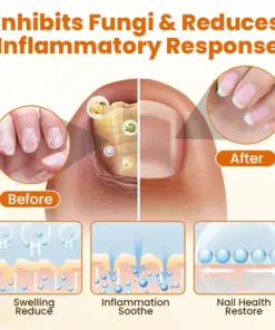 Timilk® FungiBee Advanced Nail Repair Spray