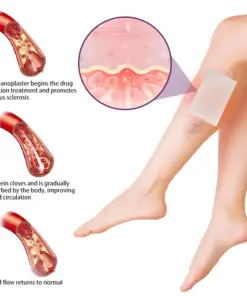 Timilk® Polidocanol Nano Varicose Vein Patch