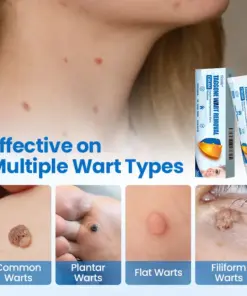 Timilk® TagGone Wart Removal Cream
