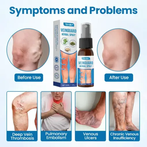 Timilk® VeinGuard Herbal Spray