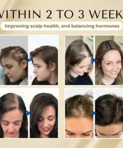Timilk® VitaStrand Biotin Hair Growth Spray
