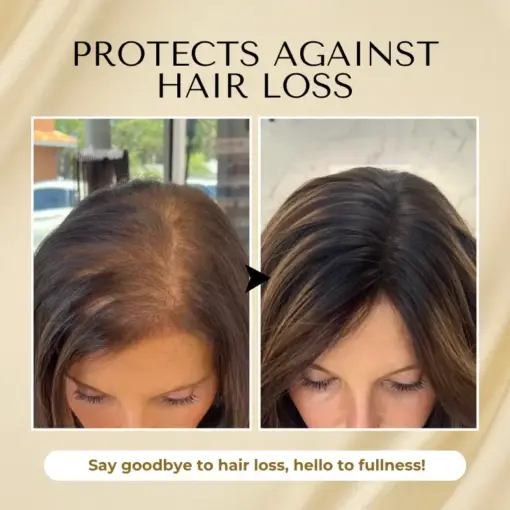 Timilk® VitaStrand Biotin Hair Growth Spray