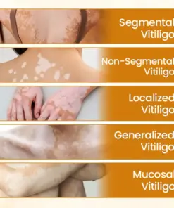 Timilk® VitiCalm Bee Venom Cream