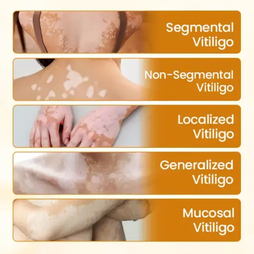 Timilk® VitiCalm Bee Venom Cream
