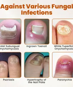 Timilk® BeeGuard Antifungal Drops