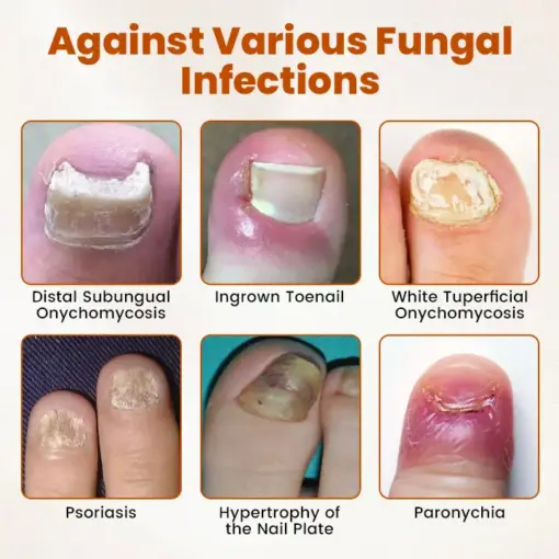 Timilk® BeeGuard Antifungal Drops