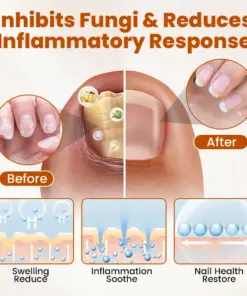 Timilk® BeeGuard Antifungal Drops
