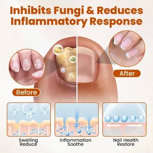 Timilk® BeeGuard Antifungal Drops