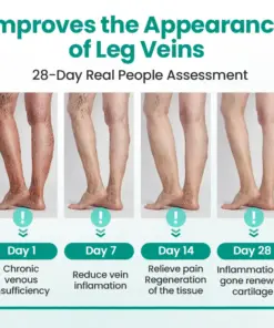 Timilk® LegRenew Varicose Veins Patch1