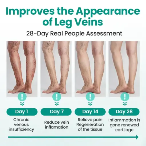 Timilk® LegRenew Varicose Veins Patch1