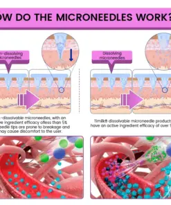 Timilk® NanoGut Patch with GLP-1