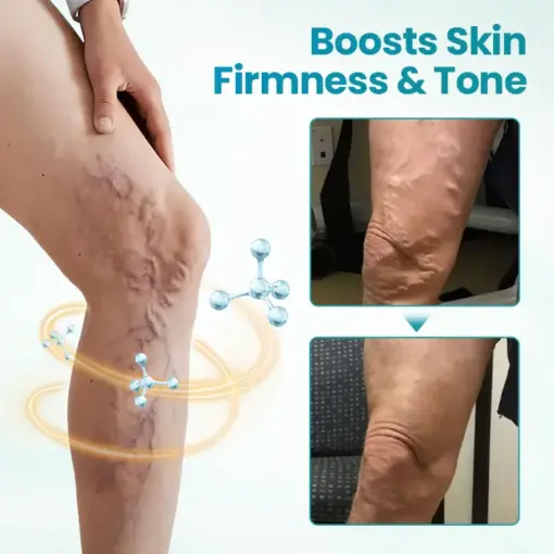 Timilk® VeinAway Relief Cream