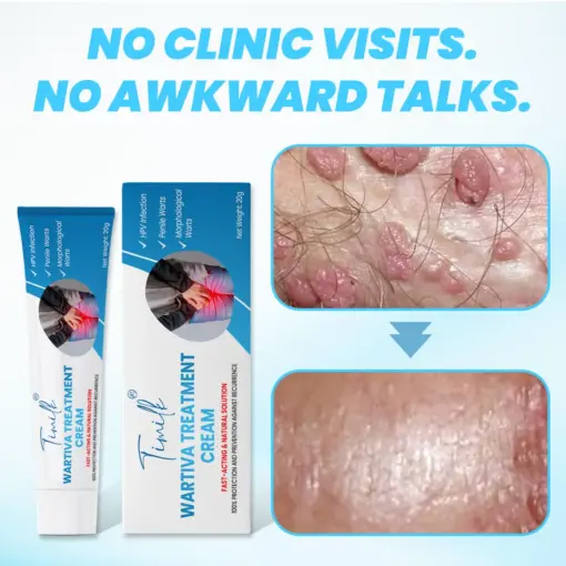 Timilk® Wartiva Treatment Cream