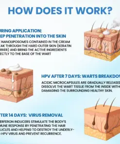Timilk® Wartiva Treatment Cream