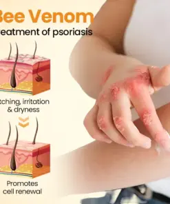 Timilk®BeeLieve Psoriasis Skin Care