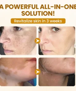 Timilk® BeeVenom Complex Repair Cream