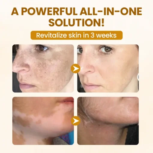 Timilk® BeeVenom Complex Repair Cream