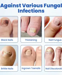 Timilk® FungalPatch - Antibacterial Fungal Patch