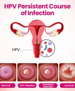 Timilk® IntiDefend Anti-HPV Interferon Gel