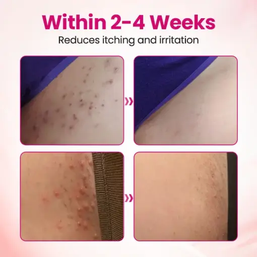 Timilk® IntiDefend Anti-HPV Interferon Gel