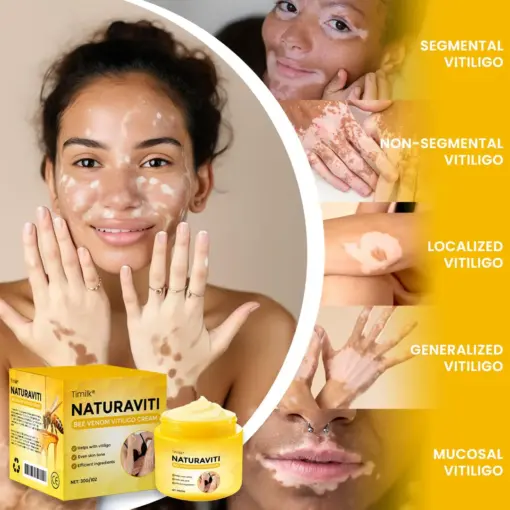 Timilk® NaturaViti Bee Venom Vitiligo Cream