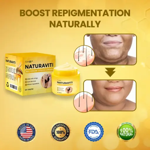 Timilk® NaturaViti Bee Venom Vitiligo Cream