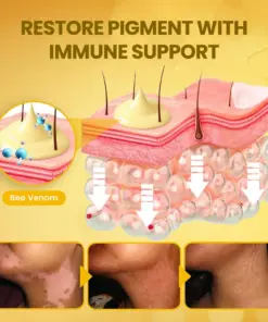 Timilk® NaturaViti Bee Venom Vitiligo Cream