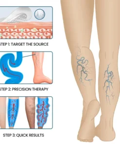 Timilk® VeinFlow Microneedle Repair Patch