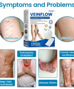 Timilk® VeinFlow Microneedle Repair Patch
