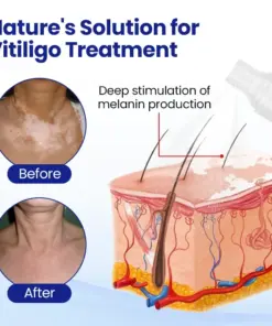 Timilk® VitiClear Herbal Spray