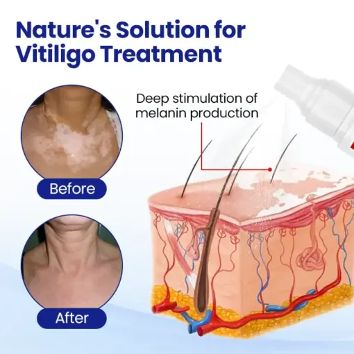 Timilk® VitiClear Herbal Spray