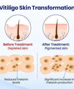 Timilk® VitiClear Herbal Spray