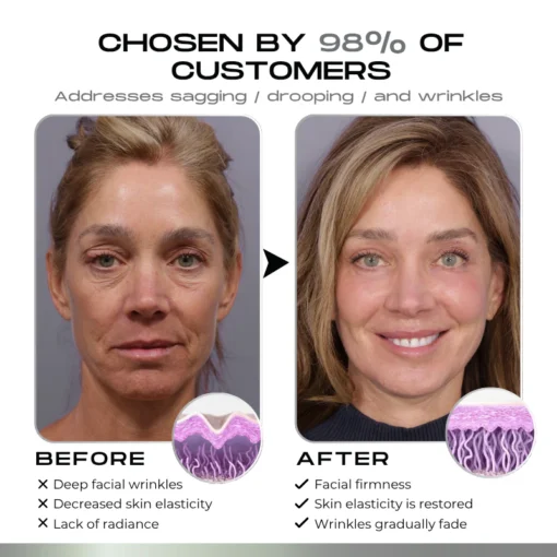 Timilk® SnapLift Instant Face Tightening Serum - Image 2