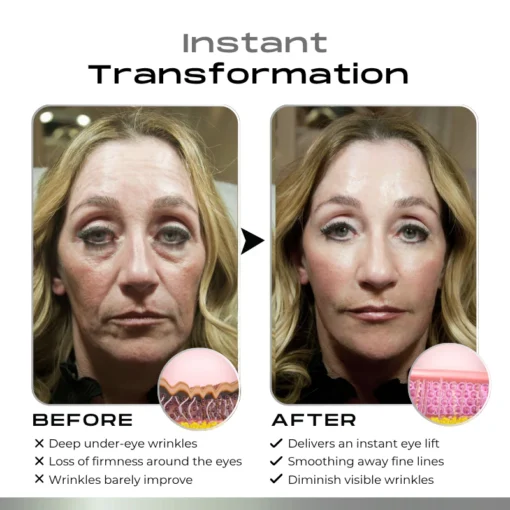 Timilk® SnapLift Instant Face Tightening Serum - Image 3