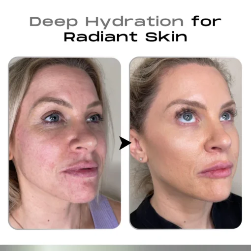 Timilk® SnapLift Instant Face Tightening Serum - Image 4