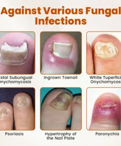 Timilk® BeeGuard Antifungal Drops