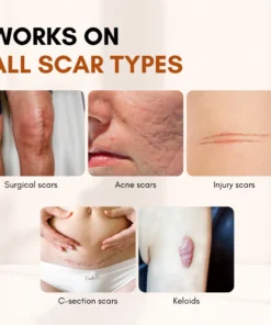 Timilk® ClearFlaw Silicone Scar Solution Stick