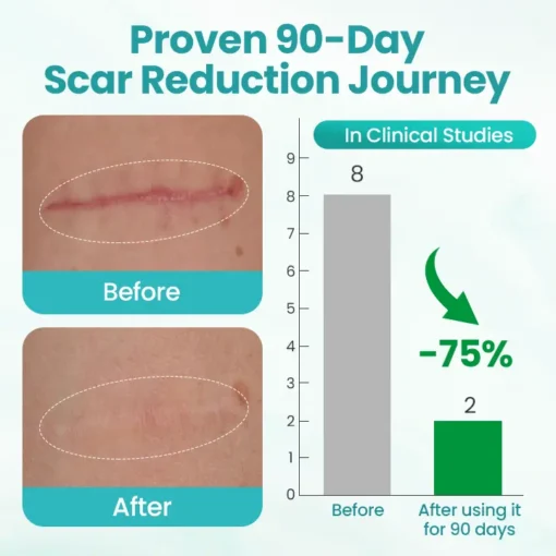 Timilk® EliteAloe ScarSolve Spray