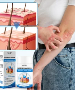 Timilk® MagnesiumHerb Psoriasis Relief Cream