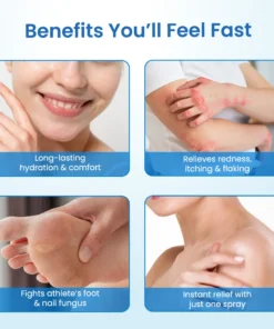 Timilk® MagnesiumHerb Psoriasis Relief Cream
